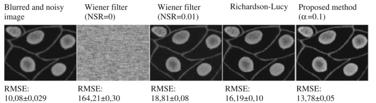Fig. 6 Comparison of proposed method with non-blind deconvolution methods for artificially blurred microscopic image corrupted by Gaussian