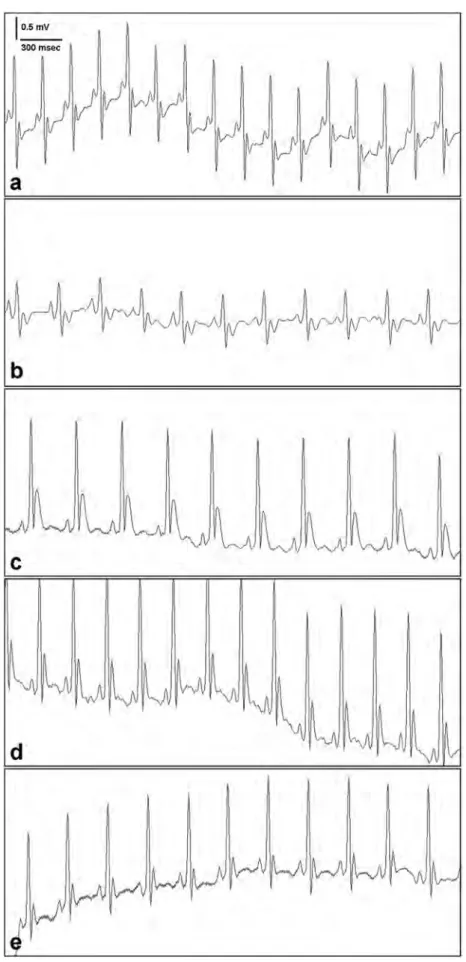 Fig. 2    ECG results of all  groups. Derivation I ECG, a  Normal Group, b DXR + saline  group, c DXR + LIR group,  d DXR + OX group, e  DXR + G-CSF Group I~ 300 msec  a  b 
