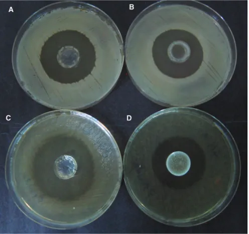 Figure 9: Agar diffusion test results.