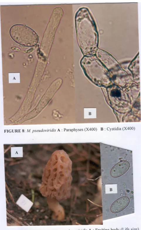 FIGURE 8:  M  pseudoviridis  A :  Paraphyses  (X400) 
