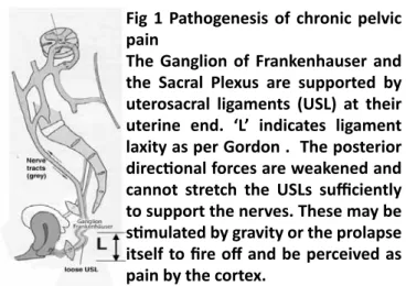 Fig 1 Pathogenesis of chronic pelvic  pain 