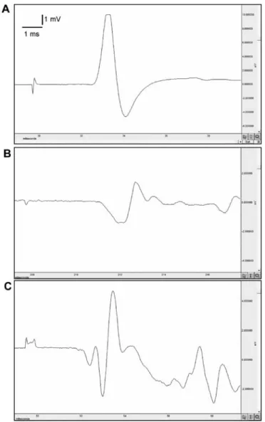 Figure 4. MDA levels in each group. The surgery + saline group MDA levels  were higher than those in the control group
