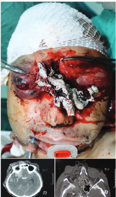 FIGURE 1. The first appearance of the patient when brought to the emergency service by ambulance