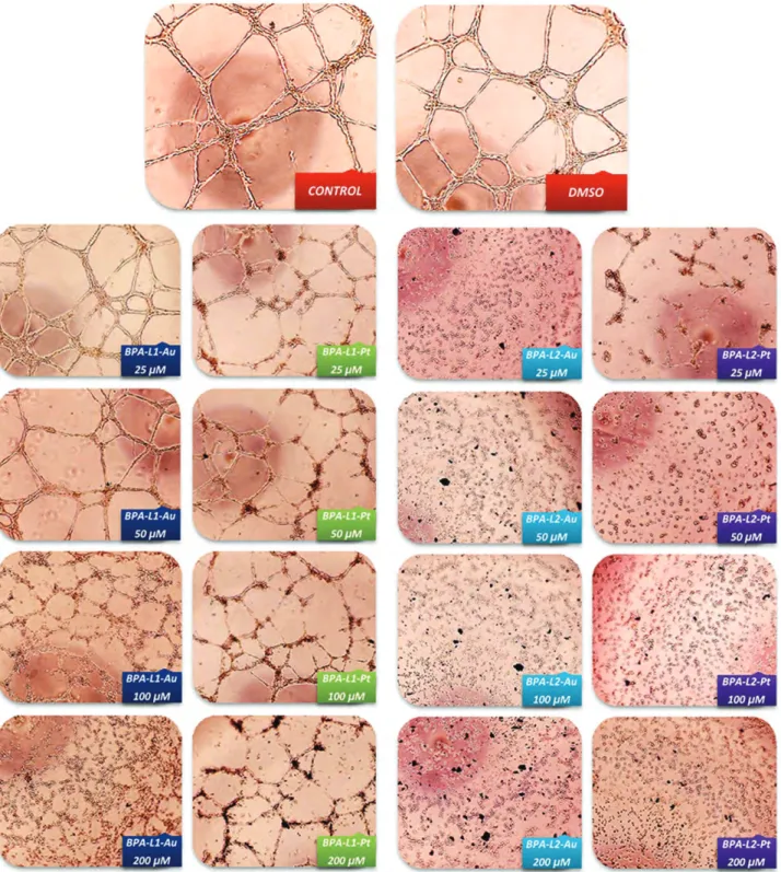 Figure 5. Activities of the synthesized organometallic complexes on human umbilical vein endothelial cell (HUVEC) tube formation and migration.