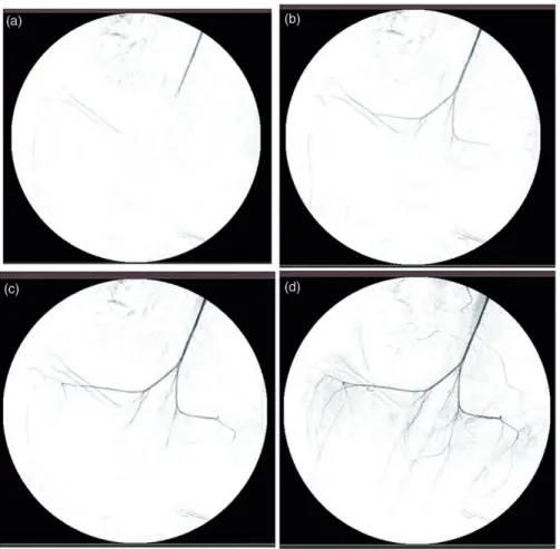 Figure 5. Dynamic angiography of left-sided anastomose from the conventional group.