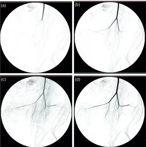 Figure 6. Dynamic angiography of left-sided anastomose from experiment group.