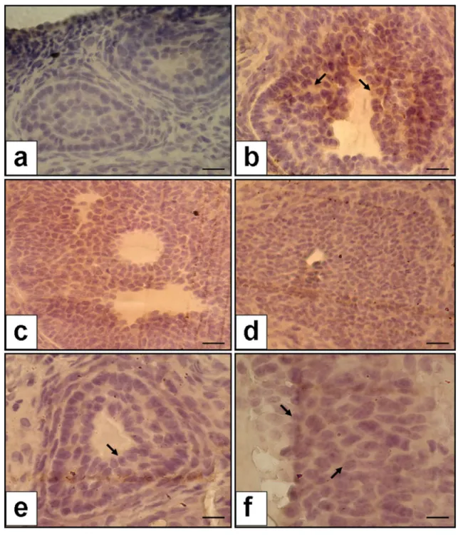 Fig. 2    VEGF immunoexpression in the ovaries (the a–e  figure  is × 40  magnification, and f figure is × 100 magnification)