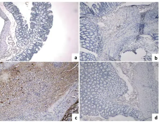 Figure 2. Immunohistochemical staining of TGF- β1. a) Control group showing weakly stained normal cells