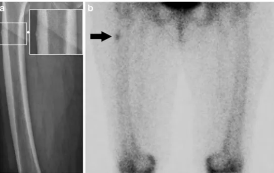 Fig. 4 a A woman aged 75 years presented with hip and back pain, and had been taking alendronate therapy for 9 years