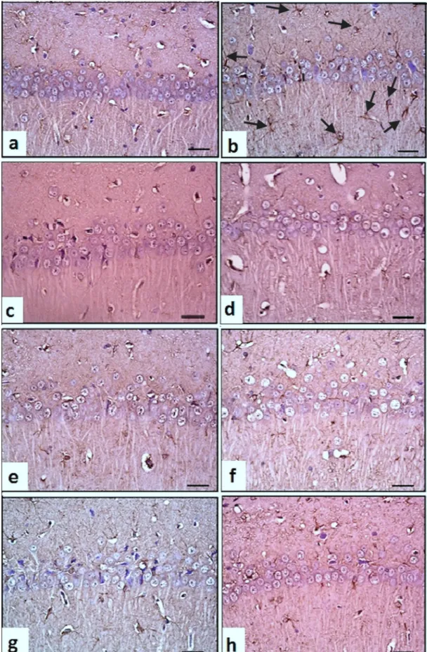 Figure 3. The effects of anticonvulsants on hippocampal CA1 neurons and GFAP ( þ) astroglial cells in PTZ-kindled rats