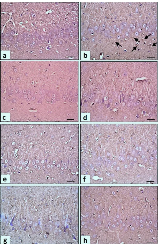 Figure 4. The effects of anticonvulsants on hippocampal CA3 neurons and GFAP ( þ) astroglial cells in PTZ-kindled rats