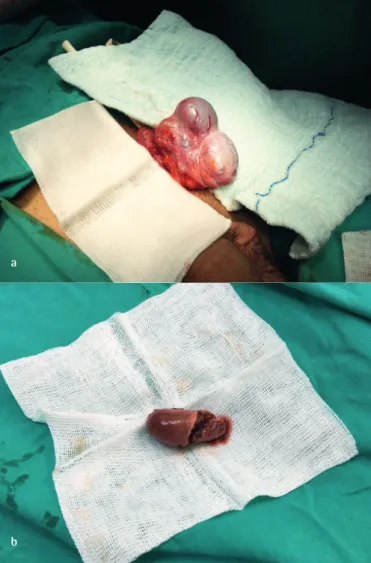 Figure 3. Permanent parafine sections revealing the sinuzoids and the white  pulp (hematoxylin and eosin, 40x)