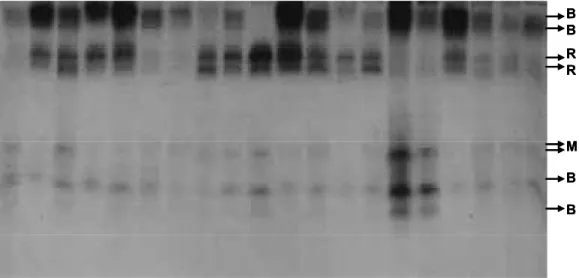 Figure 2. A photographic illustration of esterase band patterns for the Günlüklü Population