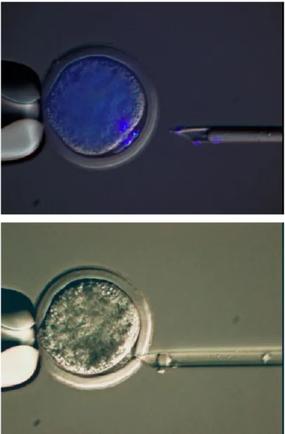 Figure 1. Hoechst 33342 stained metaphase plate and first  polar body were removed by enucleation pipette