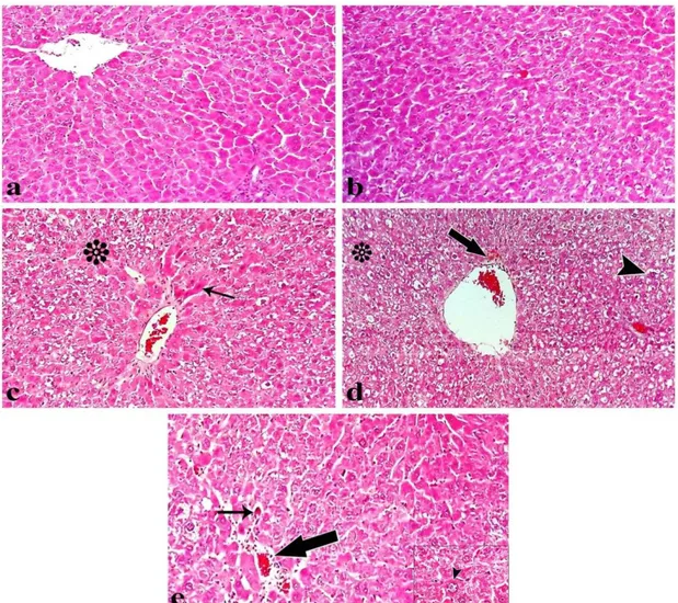 Figure 3. Light microscopy of liver tissue from rats injecting (a) control group, (b) lycopene treated group, (c) DEN treated group, (d)  lycopene+DEN treated group, (e) DEN+lycopene treated group