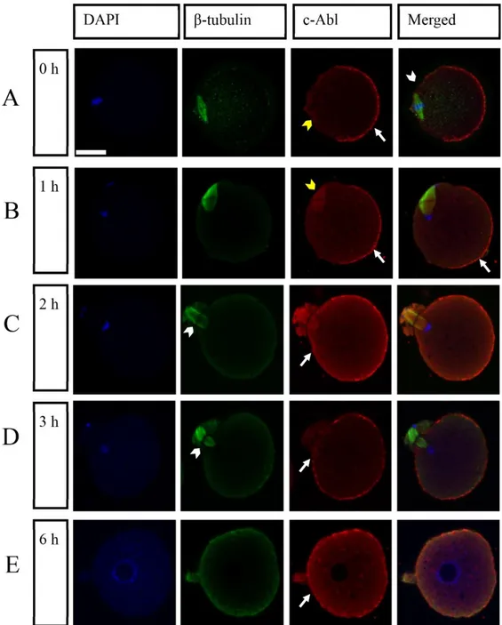 Figure 1. Distribution of c-Abl protein at MII and activated oocytes under a confocal microscopy
