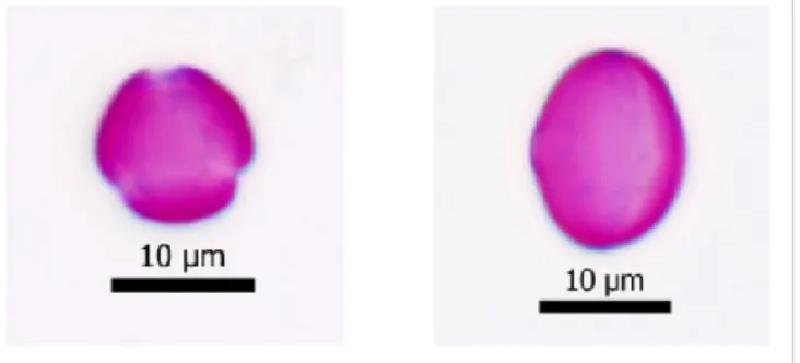 FIGURE  1.  Microphtographs  of  Castanea  sativa  pollen  from  a  chesnut  honey  pollen slide