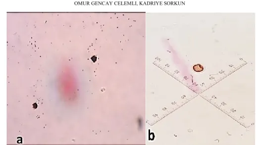 FIGURE 2.  a) Spores b) Taenia egg detected in a honey sample by microscopic  analysis