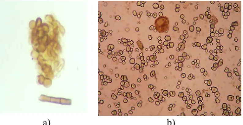 FIGURE  3.    a)  Spore  and  hyphae  b)  Starch  grains  that  are  detected    in    honey  sample