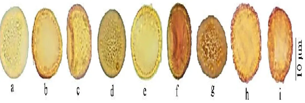 FIGURE 2. LM spore microphotograph. a-c: W. brachycarpa; d-f: W. condensa; g-i: W. 