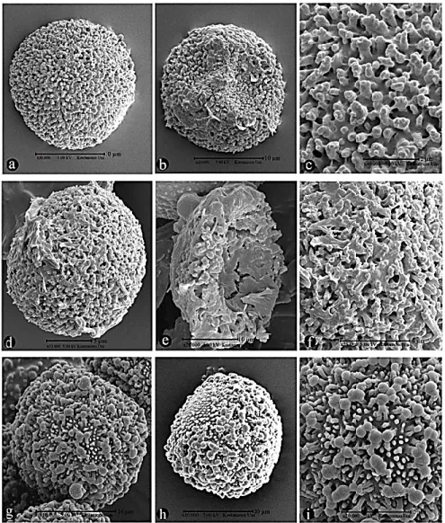FIGURE 3. SEM spore photograph. a-c: W. brachycarpa, d-f: W. condensa; g-i: W. 