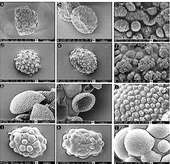 FIGURE  3.  SEM  spore  photograph.  a-c:  Bartramia  pomiformis;  d-f:  B.  halleriana;  g-i: 