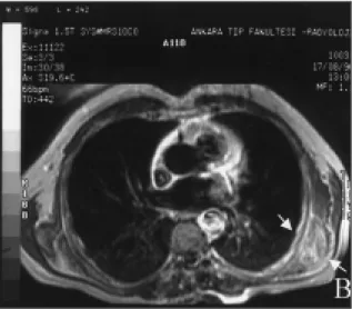 Figure 4: The mass demonstrated mild enhancement