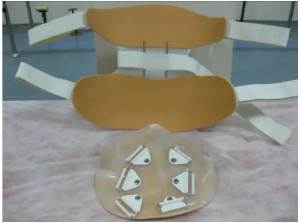 Figure 5. Anterior and posterior view of modified chairback orthosis. 