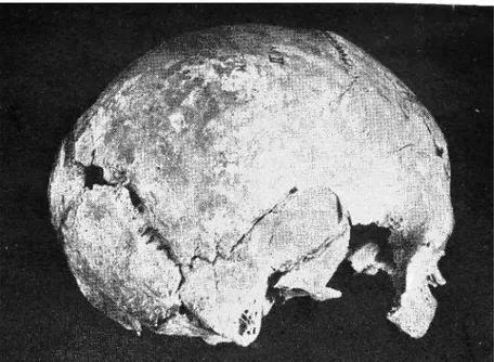 Fig. 2: The Skull of Alaca Höyük Al. H. MII in norma lateralis 