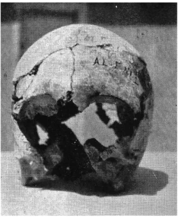 Fig. 7: The Skull of Alaca Höyük Al. F. No. I in norma frontalis 