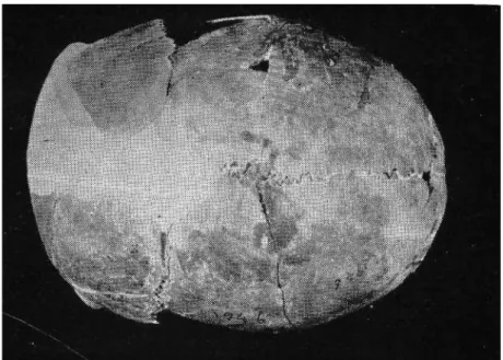 Fig. 10: The skull, found in 1946 in the Copper Age stratum,  ın norma lateralis, 