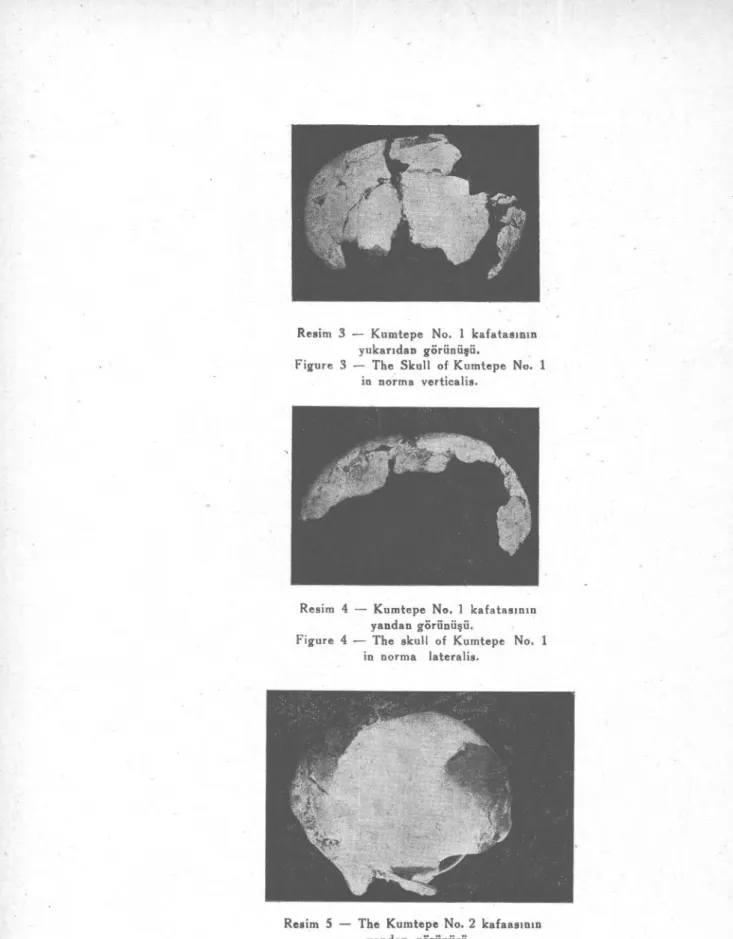 Figure 3 — The Skull of Kumtepe No. 1  in norma verticalis. 