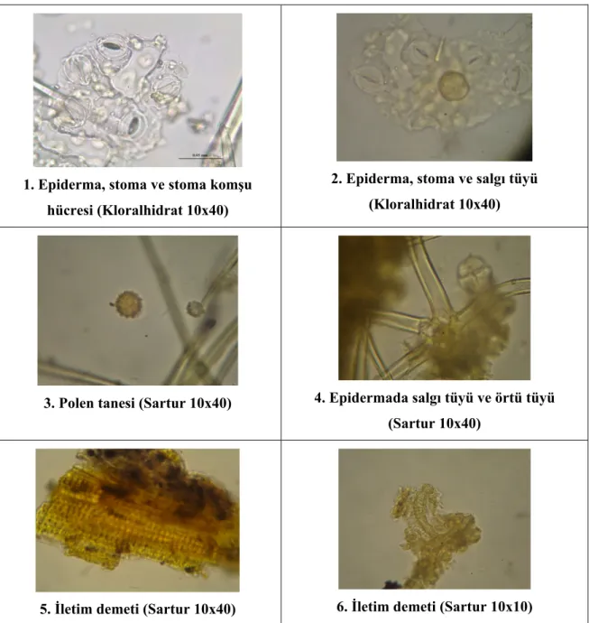 Şekil 3. Althaea folium tozu mikroskobik görünümü 1. Epiderma, stoma, stoma komşu hücresi,  2