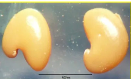 Şekil 2. O. sessilifolia polenin taramalı  elektron  mikroskobundaki (SEM) görüntüleri a, b, c, d