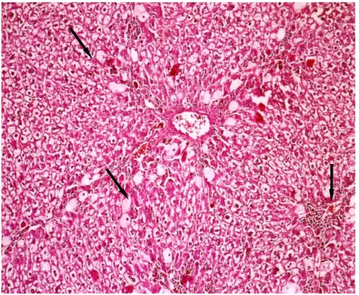 Figure 1. Numerous ballooned hepatocytes are seen in the liver of the CCl 4  group (Hematoxylin-eosin stain, 