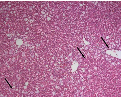 Figure 2. A few ballooned hepatocytes are seen in the liver of the CM (100 mg/kg) group (Hematoxylin-