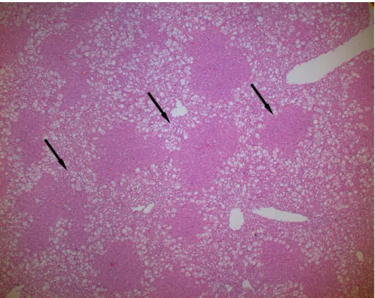 Figure 4. Bridging necrosis are seen in the liver of the CM (200 mg/kg) group (Hematoxylin-eosin stain, 
