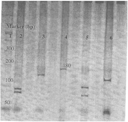 Figure 2. The restriction fragments and amplification product of the p53 gene exon 5  sequence
