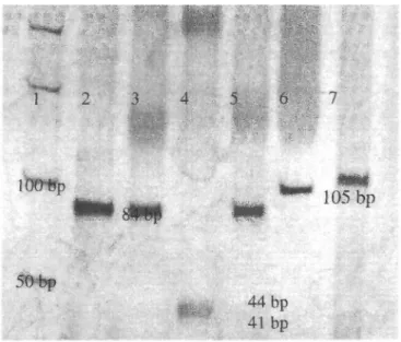 Figure 3. Silver stained polyacrylamide gel shows restriction enzyme analysis of the amplified 