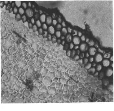 Şekil 8: A. percicus A- Anatomik çizim, a- şematik çizim, B- fotoğraf. 1- emici  tüyler, 2- epiderma, 3- hipoderma, 4-korteks, 5- rafit, 6- endoderma, 7- perisikl,  8-floem, 9- ksilem, 10- öz 