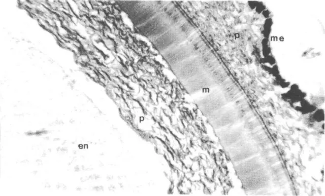 Şekil 3 - Tohumun enine kesiti (130 X). me- müsilajlı epidermis, p- parenkima, m- malpigi 