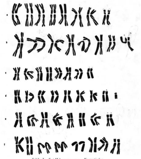 Şekil 2. Sect.Melanocrommyum: Karyotipler. 