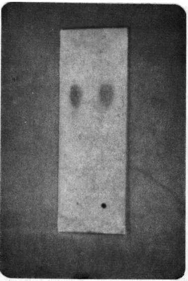 Şekil 3. Parakuat'm İdrar Örneği Ekstraktının İ.T.K'daki Kromatogramı-Mikroplaklar  üzerinde