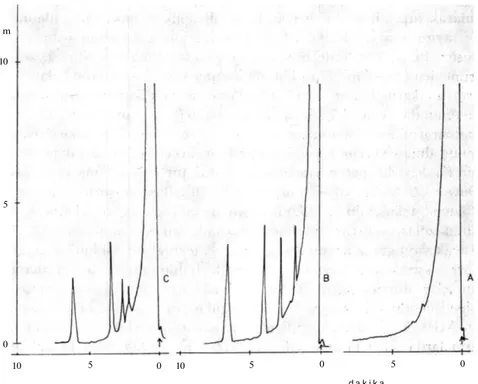 Şekil 5. Parakuat Ve Dikuat'ın İdrar Örneği Ekstraktlarının Gaz Kromatogramları.  A: Boş İdrar ekstraktı, B: Parakuatlı idrar ekstraktı (0.5 g), C: Dikuatlı idrar ekstraktı 