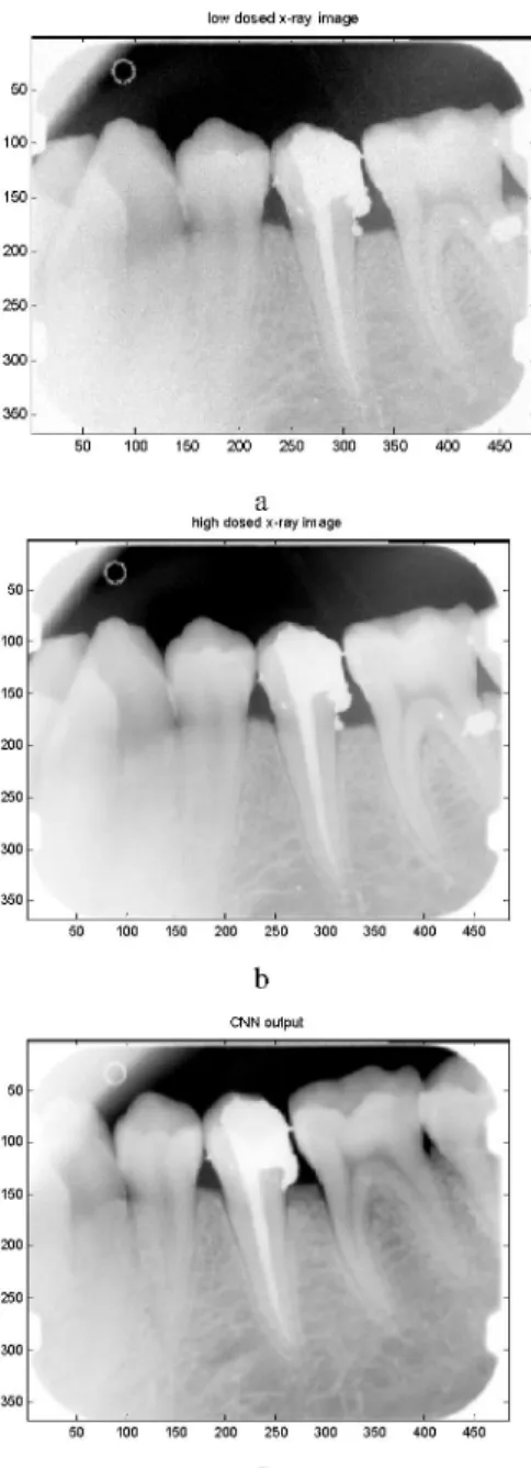 Figure 5. a) CNN input (low dosed x-ray image) b) Target (high dosed x-ray image  b) CNN output 