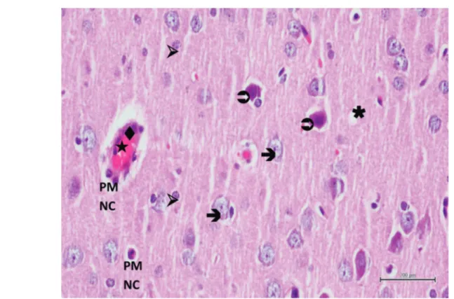 Figure 5. Hematoxylin-eosin staining of brain tissue in the experimental trauma group; : edematous neuron, : degenerated neuron, : swollen astrocyte, : dilated and congested blood vessel, : swollen endothelial cell, PMNC: polymorphonuclear cell, ✱: va