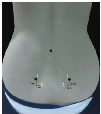 Table 5 and Figure 3 show the mean pain scores during labour as  well as changes in the mean pain scores