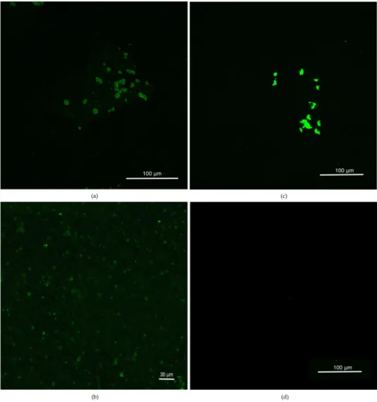 Figure 1. Confocal images at 488 nm with several magnifications as defined while (a) high and (b)  low magnification of naïve dexosomes 2 h following staining (c) only CellMask Green dye (d) blank  as the control