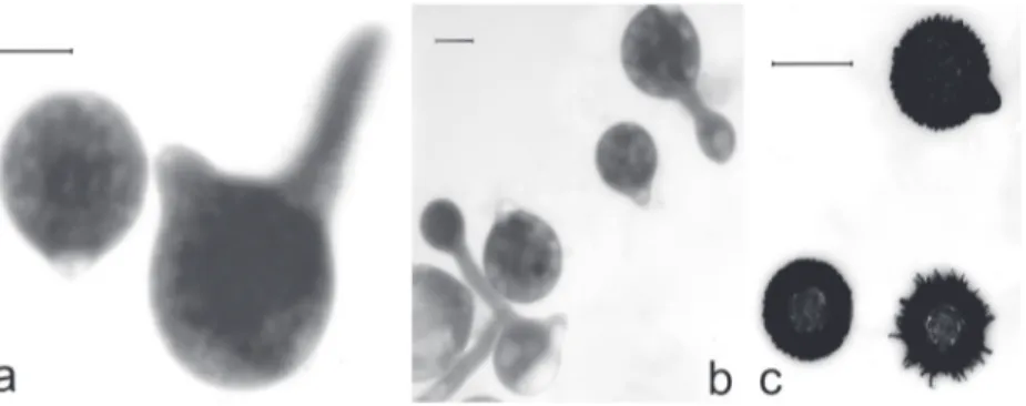 Figure  1.  Conidiobolus  coronatus:  a—  primary  conidium  and  germinating  primary  conidium;  b— primary conidia and secondary conidia produced on germ tube arising from primary conidia;  c— villose conidia may be the equivalent of resting spores in t