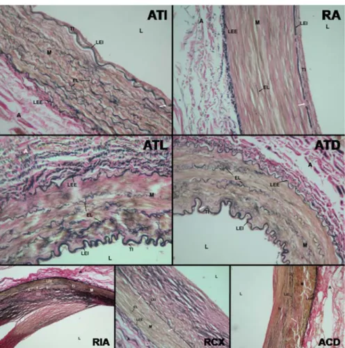Şekil 2: (a, b, c: arterin başlangıç, orta, son kısmı, L: lümen, TI: tunica intima, M: tunica media